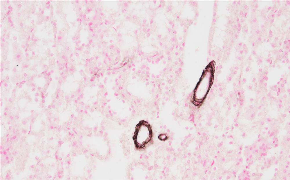 Aurion_Silver_Micrograph_2.jpg